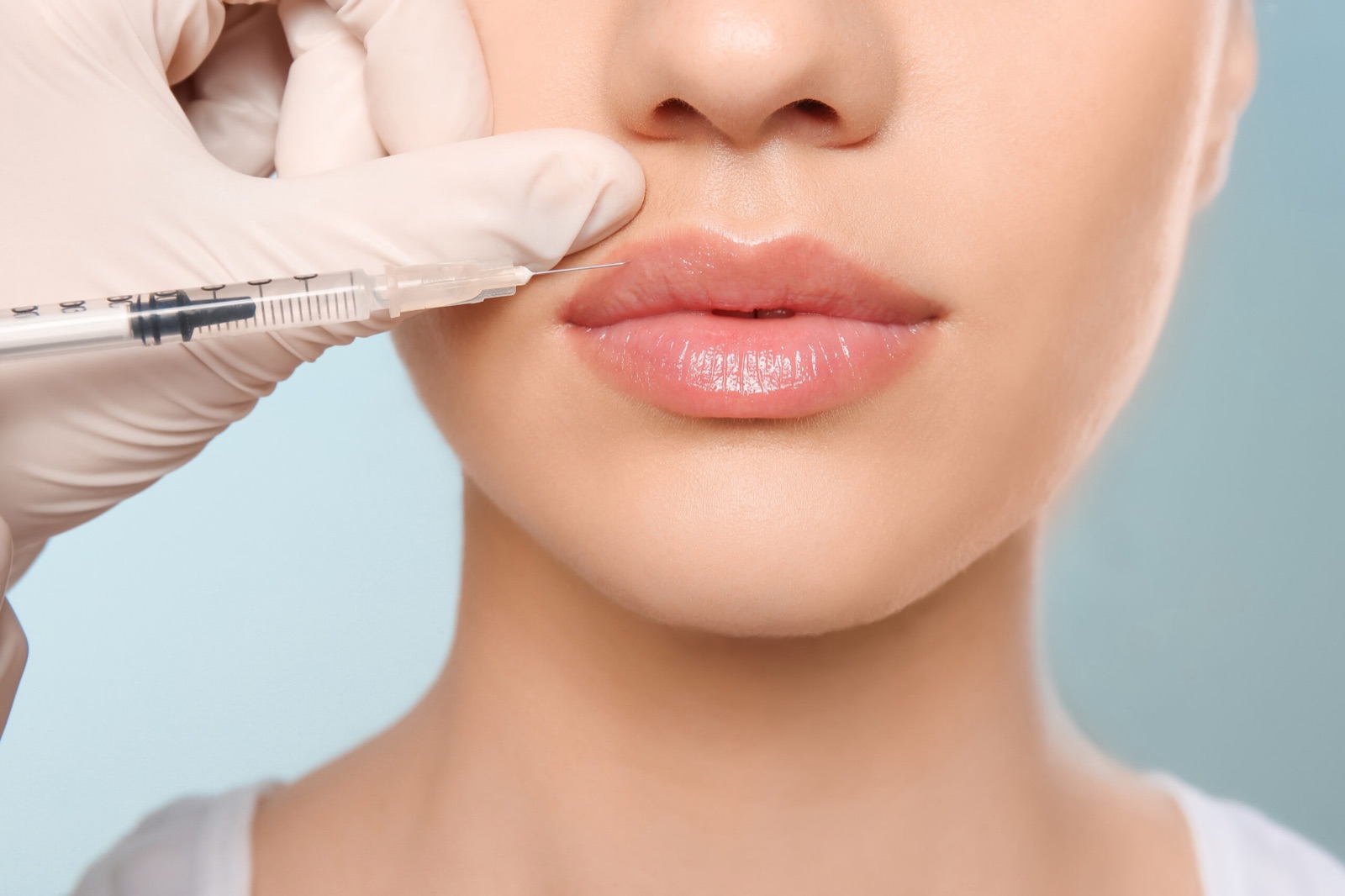 A provider placing dermal filler with a fine needle